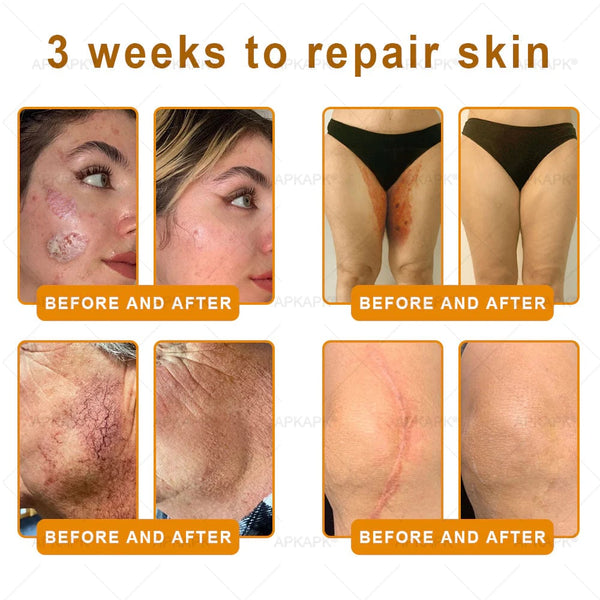 Bee Venom Skin Renewal Cream